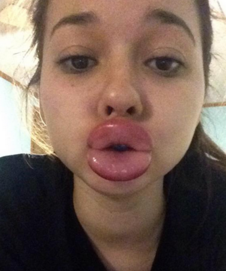 Kylie Jenner Challenge When Good Lips Go Bad